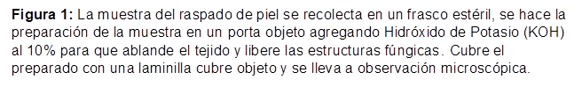 Figura 1: La muestra del raspado de piel se recolecta en un frasco estéril, se hace la preparación de la muestra en un porta objeto agregando Hidróxido de Potasio (KOH) al 10% para que ablande el tejido y libere las estructuras fúngicas. Cubre el preparado con una laminilla cubre objeto y se lleva a observación microscópica.

